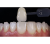 Smile Lite MDP - подсветка для дентальной фотографии, для смартфона