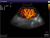 Sonoscape S40 Аппарат УЗИ Sonoscape S40 Аппарат УЗИ