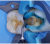 Smile Lite MDP - подсветка для дентальной фотографии, для смартфона
