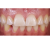 Smile Lite MDP - подсветка для дентальной фотографии, для смартфона